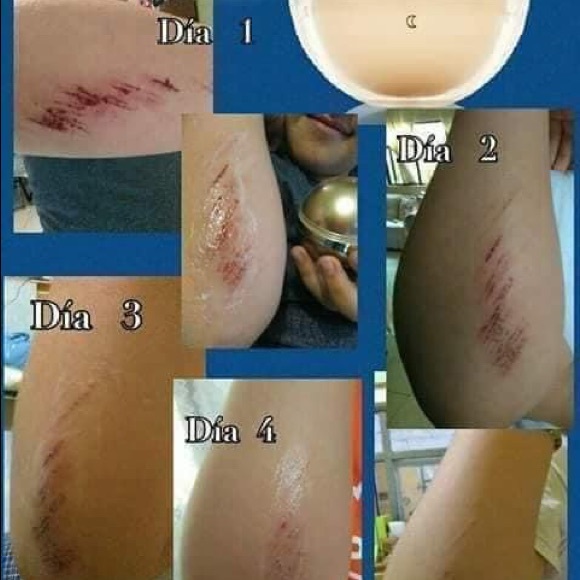 Cellular Strength System - Picture 6 of 6